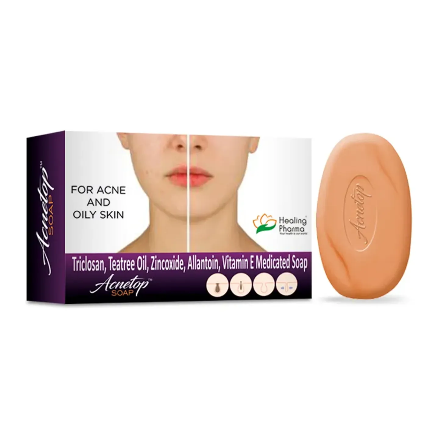 Acnetop Soap product image