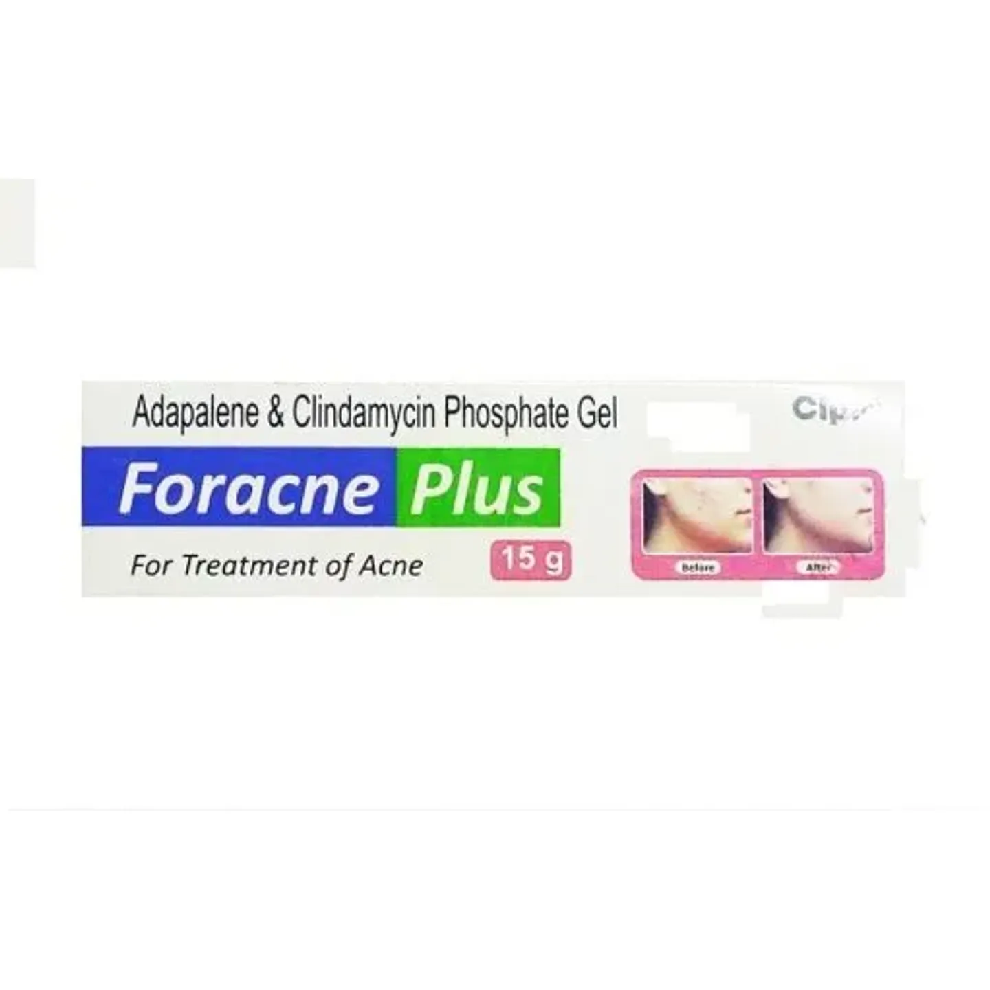 Foracne Plus Gel 15gm product image