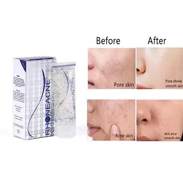 Rhone Acne Face Wash product image